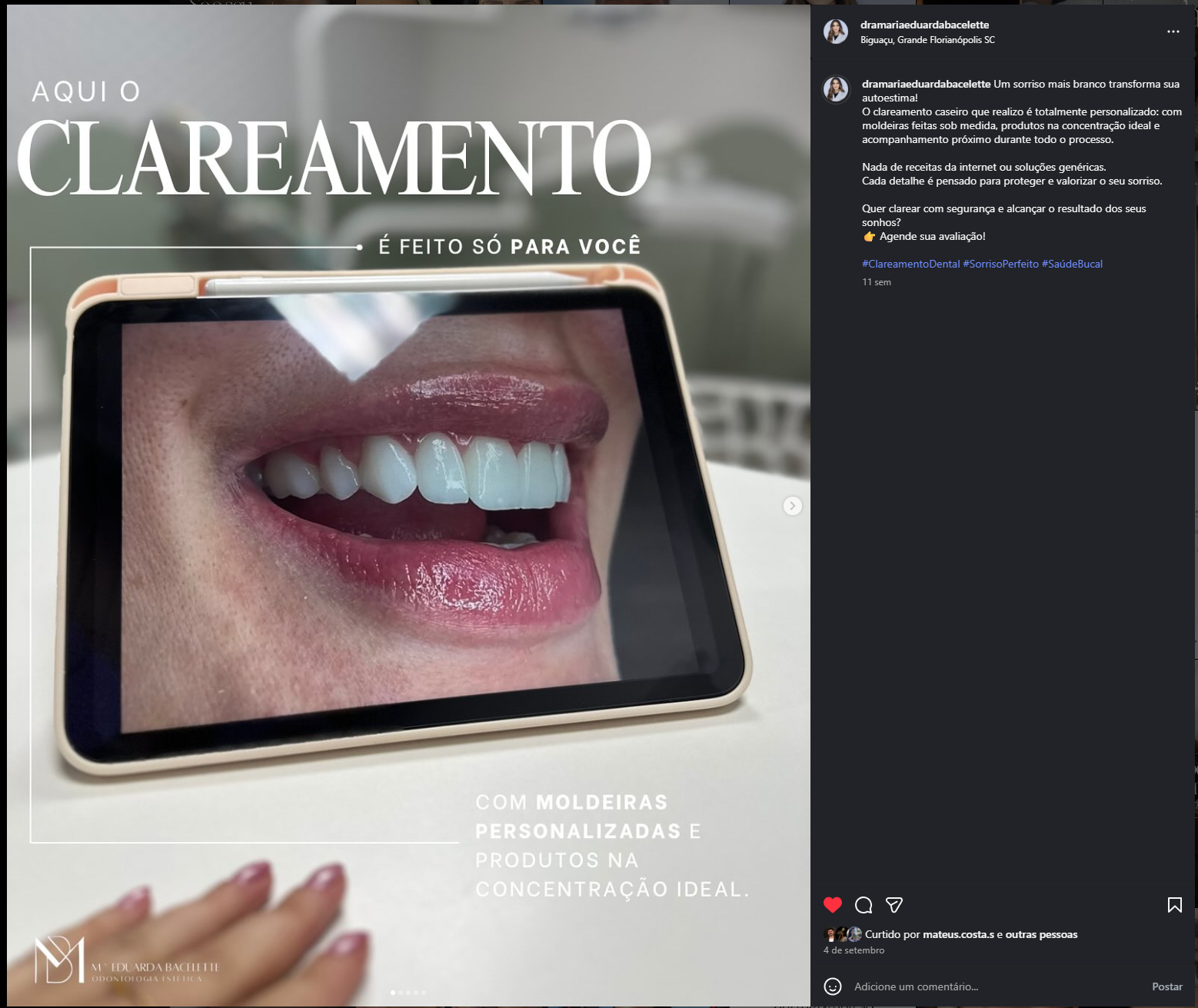Clareamento dental personalizado
